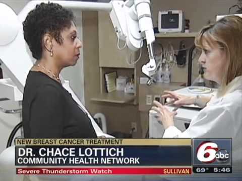 WRTV6 - Single Dose Radiation (IORT) Breast Cancer Treatment