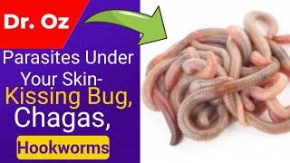 Dr Oz: Parasites Under Your Skin- Kissing Bug, Chagas, Hookworms