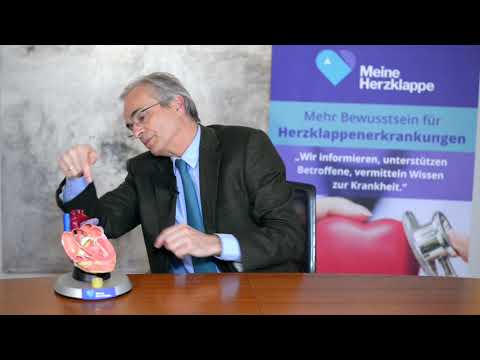 Wann sollte eine 3D Echokardiographie durchgeführt werden?