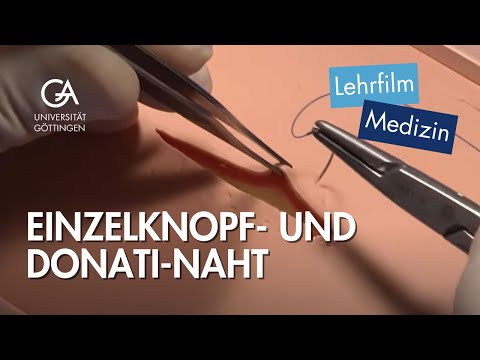 Einzelknopf- und Donati-Naht