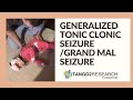 Generalized Tonic Clonic Seizure / Grand Mal Seizure