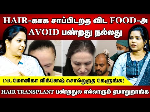 HAIR TRANSPLANT பண்றதுல எல்லாரும் ஏமாறுறாங்க | Dr Monika Vignesh | PureSid Natural Wellness Centre
