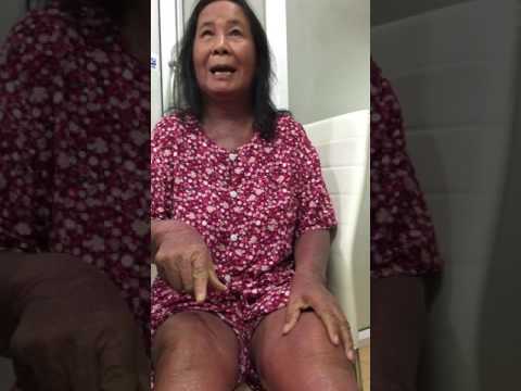 รีวิวของยาเสพติดในการรักษาโรคสะเก็ดเงิน โรคสะเก็ดเงินเกินตา