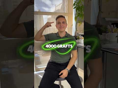 4000 Grafts Hair Transplant