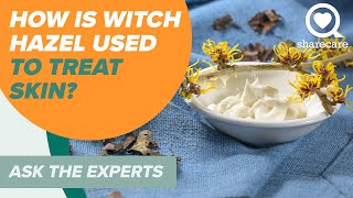 How is Witch Hazel Used to Treat Skin | Ask The Experts | Sharecare