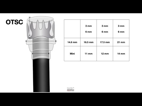 HCC 1475-28B  OTSC Clips