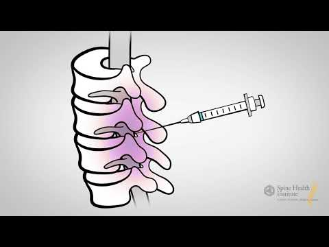 Pain management injections