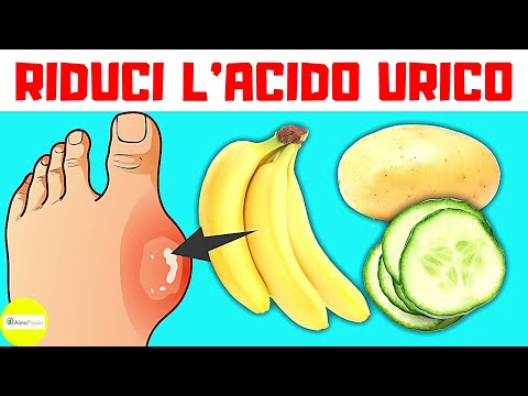 The Devastating Effects of Uric Acid / Gout