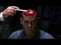 Hannibal Lecter feeds Krendler his last meal 