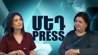 Ի՞նչ առանձնահատկություններ ունի Մարգարյան ծննդատունը