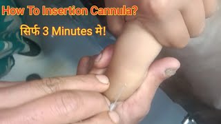 How insertion of cannula?, वीगो कैसे लगाएं?, cannula लगाने का सही तरीका #cannula #viral 