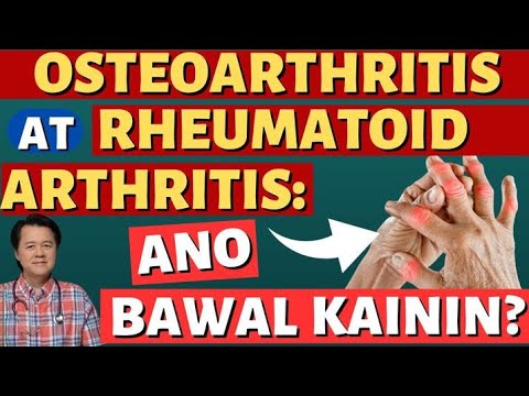Osteoarthritis at Rheumatoid Arthritis: Ano Bawal Kainin? - By Doc Willie Ong
