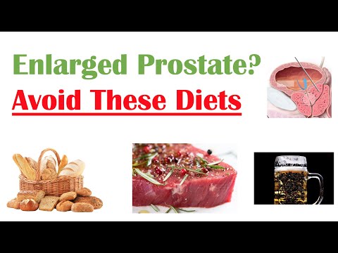 10 foods to avoid for prostate health