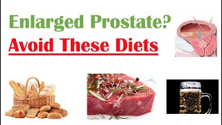 Foods to Avoid with Enlarged Prostate | Reduce Symptoms and Risk of Prostate Cancer