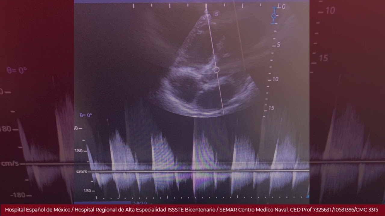 Marcelo Utrera Lagunas-118