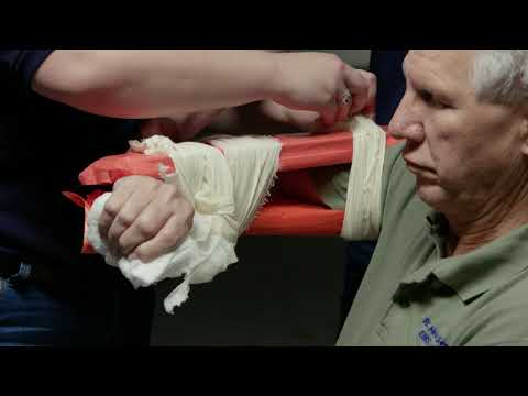 JOINT IMMOBILIZATION   ELBOW  RC Health Services National Registry