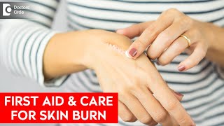 Fluid filled blister after a burn Right way to deal it - Dr. Rasya Dixit| Doctors