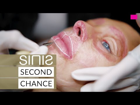 SINIS SECOND CHANCE – A big surprise for a brave young woman! ❤️