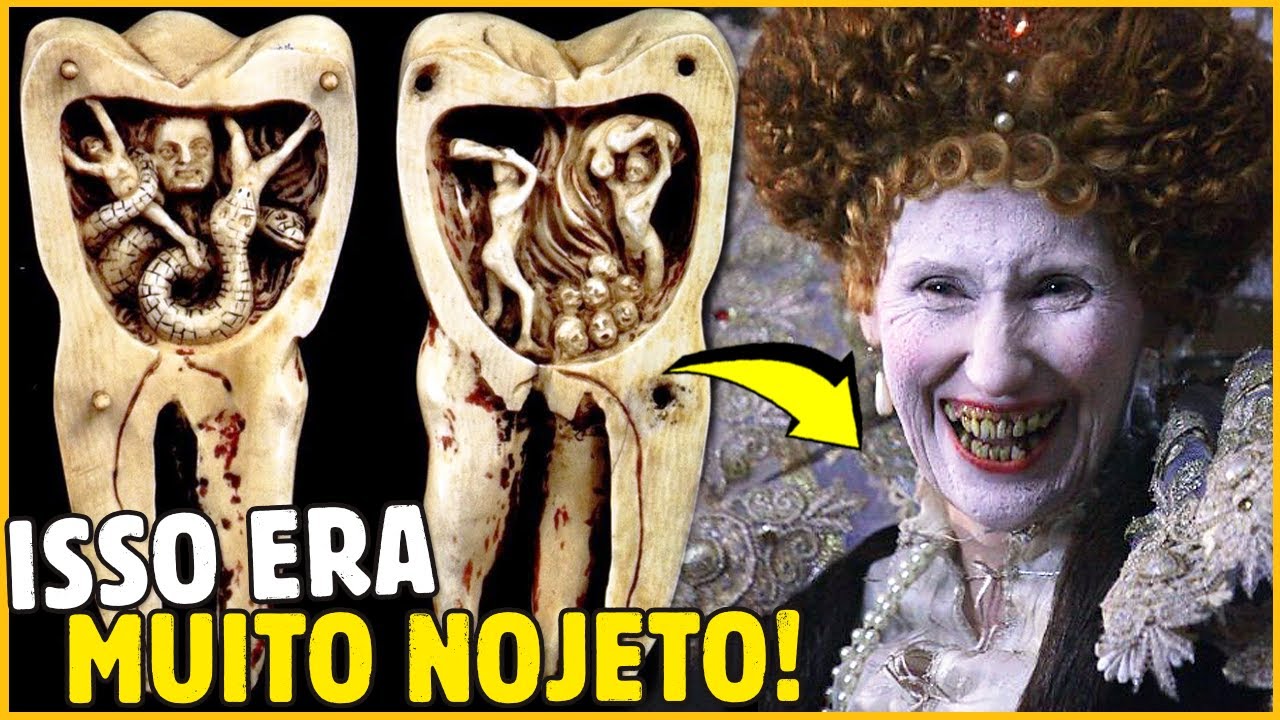 POR QUE DENTES PODRES FAZIAM TANTO SUCESSO NO PASSADO?