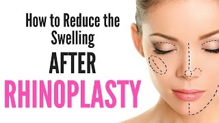 How to Reduce the SWELLING after Undergoing RHINOPLASTY?