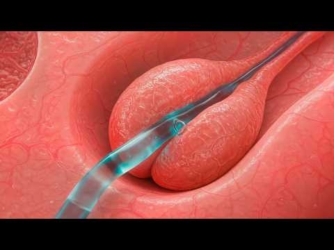 What Is Female Ejaculation? How Squirting Really Works