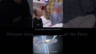 Download lagu Interview with Penis Silicone Injections Patient mp3