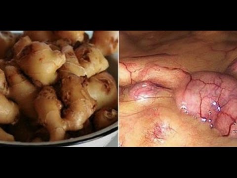 Dugo pagtatasa ng mga problema ng labis na timbang Kung ang alak ay makakatulong upang mawala ang timbang