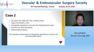Download Lagu VESS Winter Annual Meeting (Virtual), Case Reports u0026 Video Presentations Session, Talk 3 Thumbnail