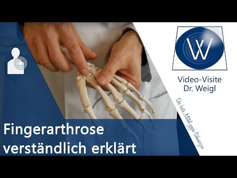 Daumenarthrose & Fingerschmerzen: 🤔Verstehen Sie was Rhizarthrose ist? Ursachen, Symptome, Therapie