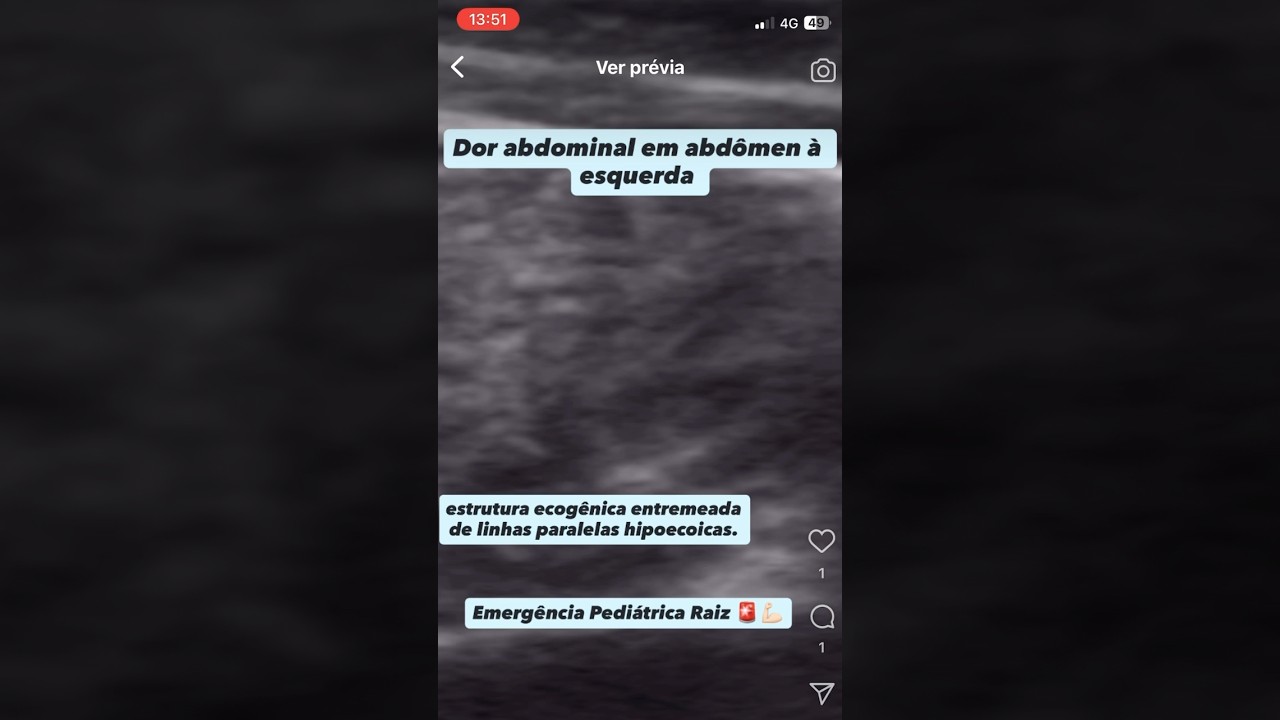 Rubem Antonio Citton Junior-15