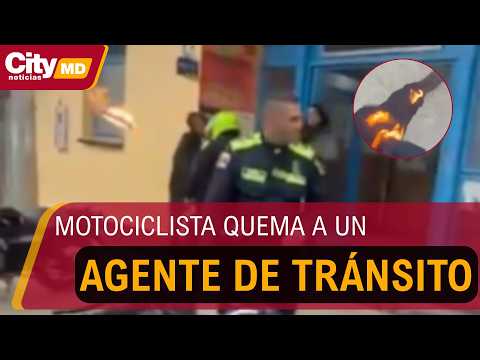 Motociclista quemó a un agente de tránsito durante procedimiento en Guasca | CityTv