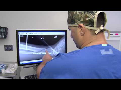 Dr. Anthony F. Infante, Jr. - Florida Orthopaedic Institute, Hip & Thigh, Knee & Leg