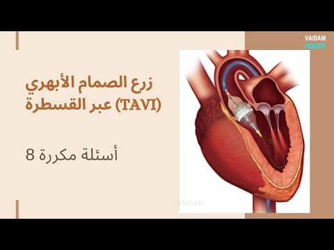الأسئلة المتداولة حول تافي