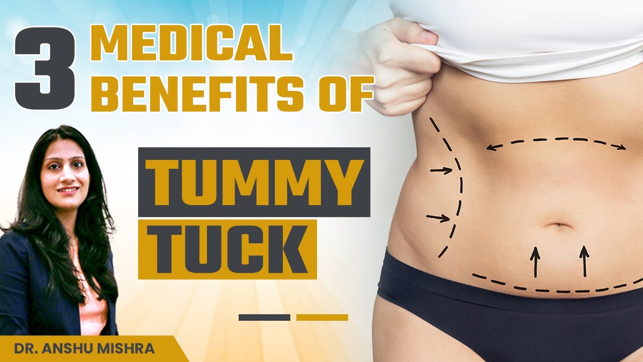3 Medical Benefits of Tummy Tuck | Tummy Tuck Surgery in Dubai | Dr. Anshu Mishra