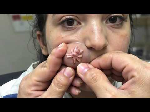 Video Thumbnail: Schockierende Dinge, die in menschlichen Körpern gefunden wurden