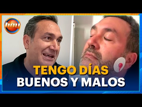 Alex Ibarra padece enfermedad que le impide hablar algunos días | Programa Hoy