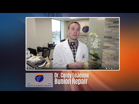 Bunion Video 1