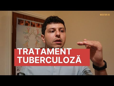 mecanismul de pierdere în greutate de tuberculoză)
