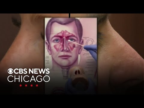 Deviated septum surgery becoming less painful, more effective, expert says