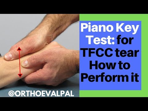 CMC Arthritis vs Dequervain s