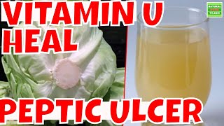 PEPTIC ULCER Vitamin U HEAL Peptic Ulcer in 10 days