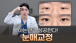 눈 성형, 쌍꺼풀만으로 충분하지 않은 이유 l 눈매교정이 필요한 경우는 따로 있습니다