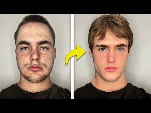 Glow up advice from someone who was actually ugly. (Looksmax Guide)
