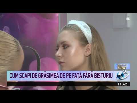 Puteți pierde în greutate având gripa