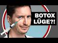Botox Lie What Alicia Joe Isn T Telling You Doctor Reacts Doc Felix