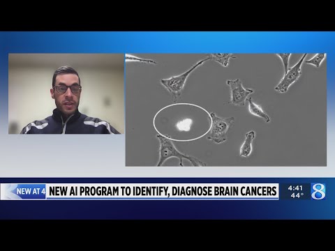 AI could help doctors learn more about brain tumors