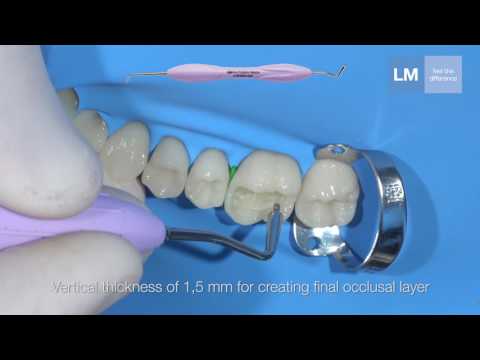 LM-Arte™ Posterior Misura - Fill evenly