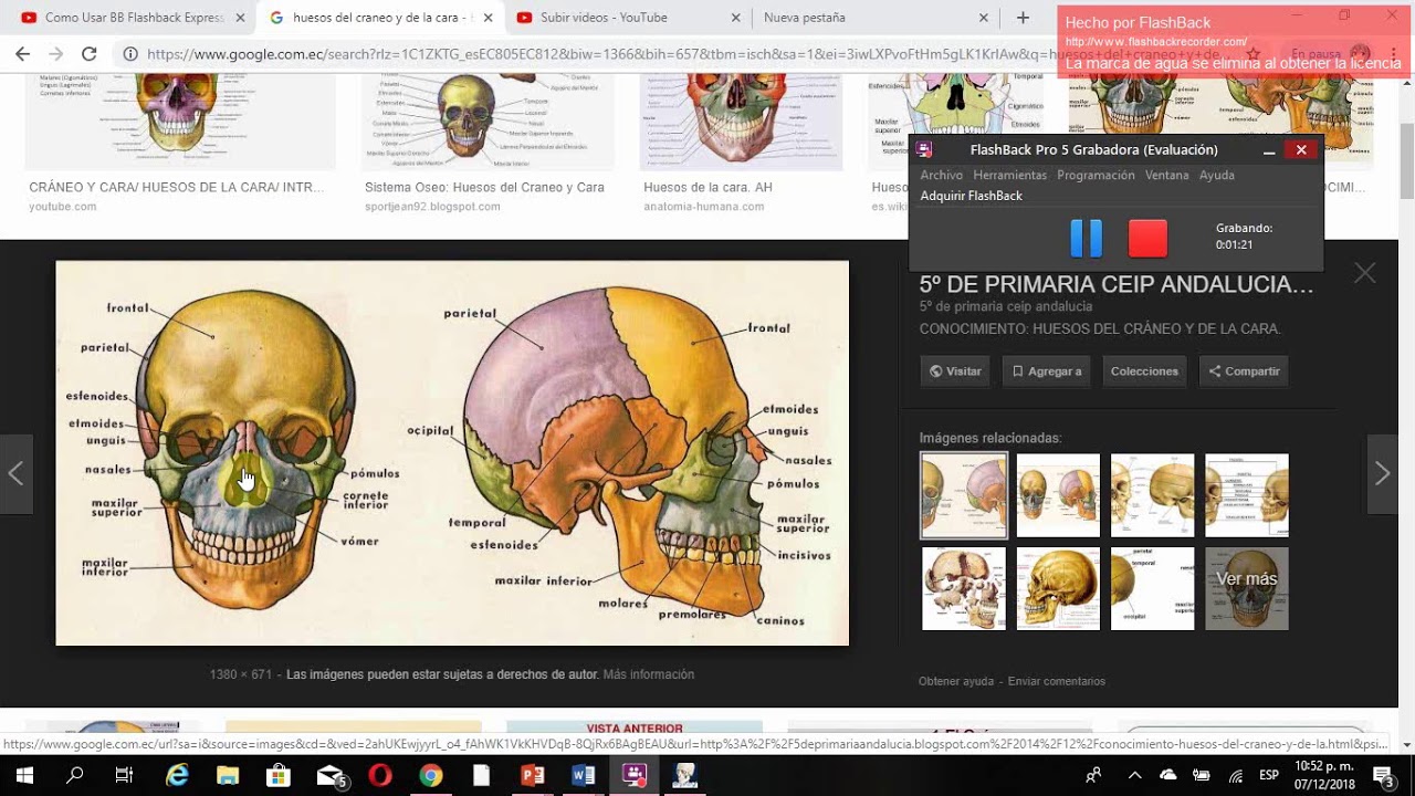 Division del esqueleto 1