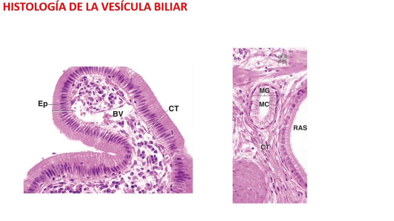Histología de la Vesícula biliar