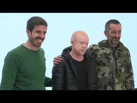 El doctor Cavadas opera a un guineano con cánceres múltiples de piel y "le regala una vida"